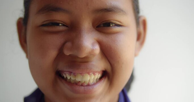 A native Asian black girl is beginning as a teenager with acne on her face and forehead is laughing happily.