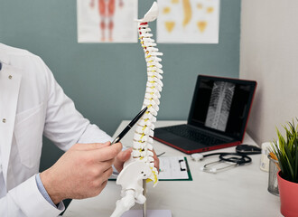 Doctor shows problem points on a spine using a spine anatomical model at a doctor's office - obrazy, fototapety, plakaty