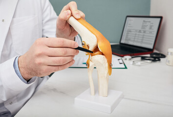 Traumatologist pointing pen to meniscus in a knee-joint anatomical teaching model, close-up. Human torn meniscus treatment concept - obrazy, fototapety, plakaty