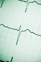Electrocardiogram close up