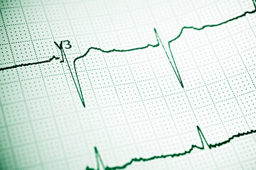 Electrocardiogram close up