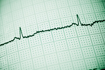 Electrocardiogram close up