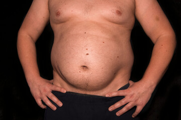 Naklejka premium A young man with obesity and a big belly.