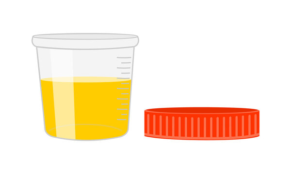 Urinalysis. Urine sample, full open plastic container with removed cover. Laboratory examination and diagnostics concept. Vector cartoon illustration.