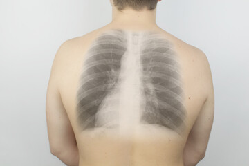 Conceptual photo. X-ray of a man from the back. An image of the ribs and lungs appeared on the skin...