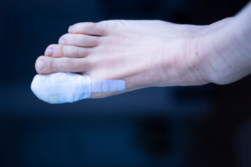 Foot big toe bandage injury