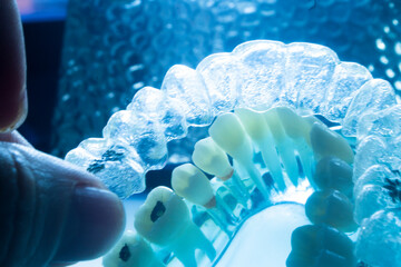 Invisible bracket aligners