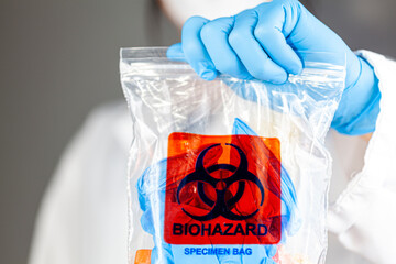 A woman researcher is holding a clear plastic bag with biohazard logo printed on. The bag contains,...