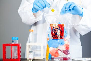 A woman researcher is holding a clear plastic bag with biohazard logo printed on. The bag contains, potentially dangerous biological specimens. Scientists discard these waste in these labelled bags.