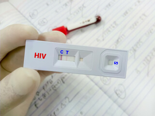 Rapid screening test for HIV (human immunodeficiency virus) screening test. Technician hold rapid...
