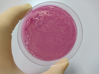 Food and drug microbial test results