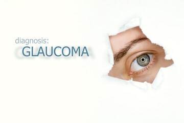 Woman`s eye looking trough teared hole in paper, word Glaucoma on left. Eye disease concept...