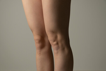 Fat legs and hips, side view. Woman`s hips closeup raw studio shot in grey background. Dieting and fat loss concept.