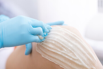 Naklejka premium female legs hair removal with sugaring procedure in beauty salon