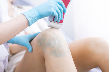 female legs hair removal with wax in beauty salon