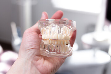 Mock up jaw with teeth holds in hand