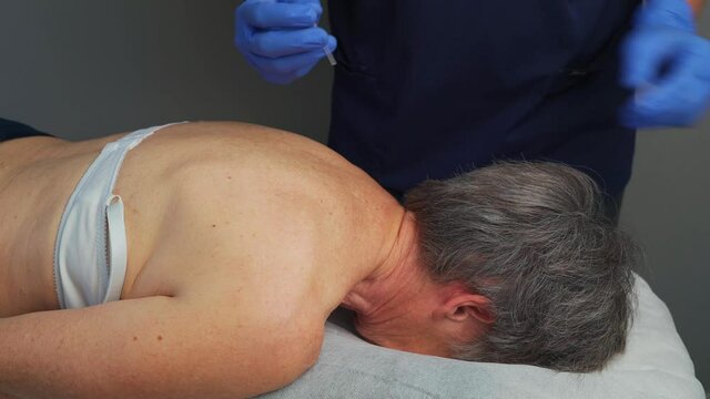 Physiotherapy session, using the Dry Needling technique, for a contracture in the trapezius muscle, in a woman.