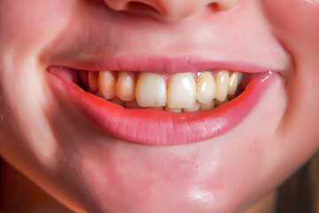 Womans lips smiling close. Girl's teeth and lips. Healthy teeth closeup shot womans. Seduction