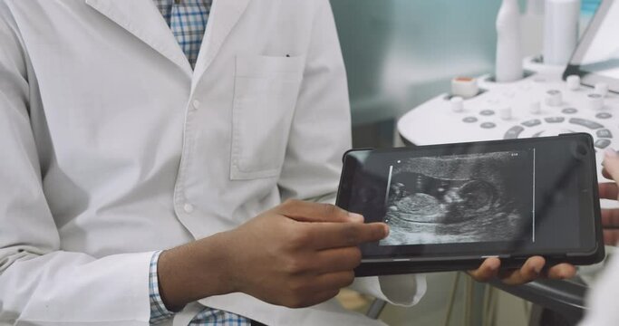 Close up cropped image of male Afrcian doctor showing digital tablet with baby ultrasound image to unregognizable pregnant woman sitting on the couch. Focus on the tablet