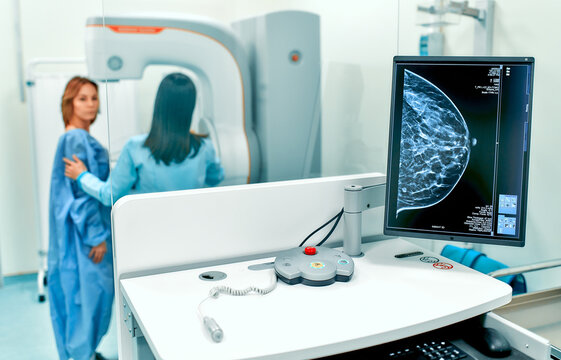 Mammogram snapshot of breasts of a female patient on the monitor with undergoing mammography test on the background. Mammography test at the hospital. Medical equipment.