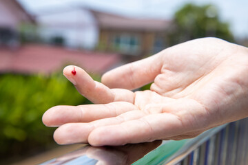 Finger with drop of fresh blood. A finger on right human hand is cut hurt and bleeding with bright red blood on blurred natural background. Man cut his finger while cooking a dinner in his kitchen.