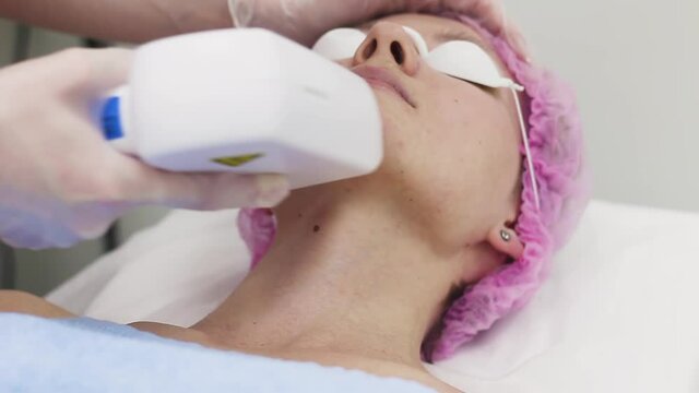 Laser IPL device in the hand of a cosmetologist. Hair removal on a woman's face. Hardware cosmetology