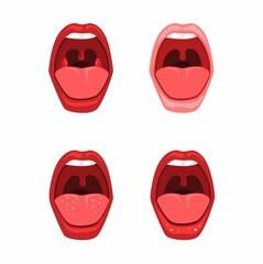 Mouth and throat sore disease icon set. health dental clinic symbol concept in cartoon illustration vector