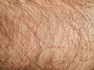 Obraz premium human skin texture