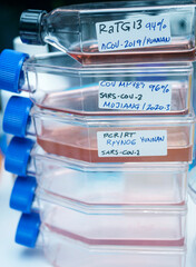 Several vials of Sars-Cov-2 strain samples from Mojiang and Yunnan in research lab, conceptual image