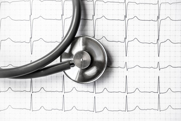 Photo of an electrocardiogram ECG or EKG printout with stethoscope. Medical health concept....