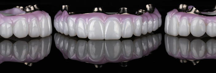 denture made of high quality dental zircon with titanium bar, collage with black background with...