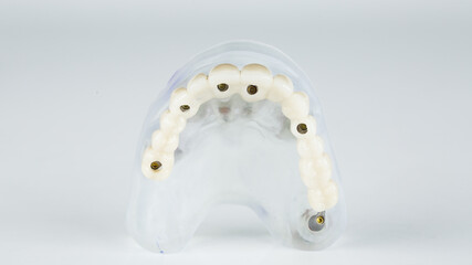 denture for the upper jaw on the model on a white background, view of the chewing part