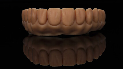 wax up dental prosthesis of the upper jaw for trying on the patient, photo in black glass with reflection © Dental Pro Content