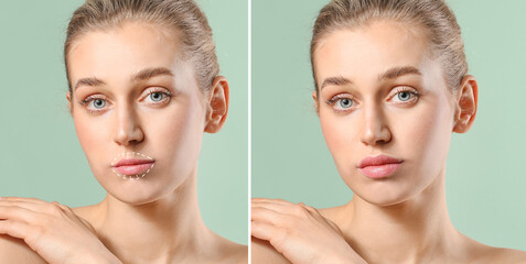 Beautiful young woman before and after lips enhancement on color background
