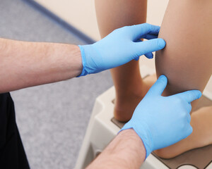 Doctor examines varicose veins on a woman's legs