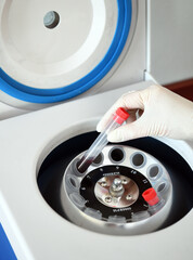 Plasmolifting. Preparation of the blood for injections. cosmetologist puts the tube of the blood in...