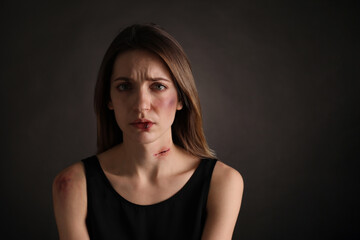 Fototapeta premium Woman with facial injuries on black background. Domestic violence victim