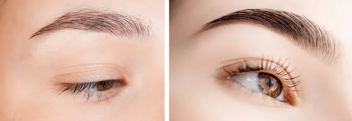 Fotobehang Before and after correction of brow hair. Young woman with beautiful eyebrows © Parilov