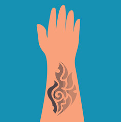 Stages of tattoo removal from skin hand.Vector flat illustration.Removal procedure unwanted tattoos.