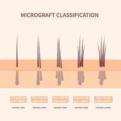 Hair micrograft classification set for hair transplantation surgery. Skin cross-section with number of hairs in the follicular unit or family. Hair science and anatomy. Cartoon vector illustration.
