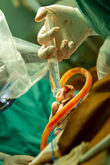 close-up of a surgeon's assistant's hand squeezing out liquid from a syringe during an operation using a surgical microscope.
