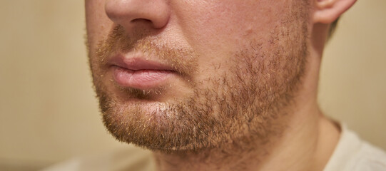 Obraz premium The beard of a light blond-haired man.