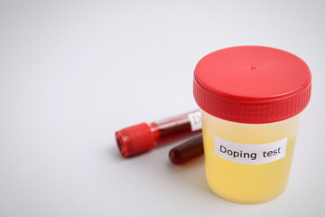 Jar with urine sample on light grey background, space for text. Doping control