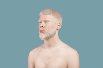 Albinism concept. Thin albino man posing without shirt and lookig aside on turquoise studio background - obrazy, fototapety, plakaty