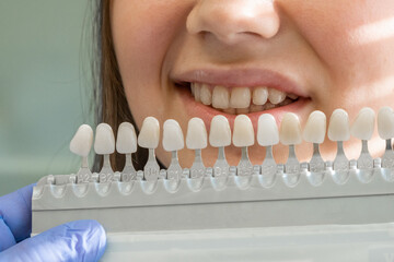 Dentist selects color palette for dental treatment smiling woman at clinic. Teeth enamel whitening concept