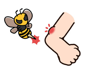 虫刺され　腕　蜂