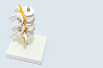 Human spine plastic model for surgery in clinic. Anatomical models of joints and nerves. Part of artificial lumbar spine model in neurology office. Medical, health, body care concept, space for text.