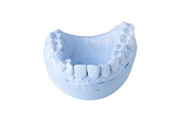 dental impression isolated on white background
