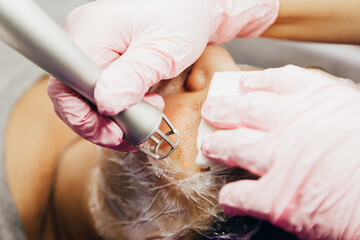 cosmetologist performs laser rejuvenation procedure. CO2 Fractional Laser