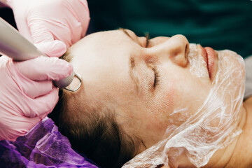 cosmetologist performs laser rejuvenation procedure. CO2 Fractional Laser